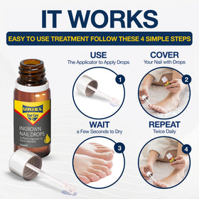 URIEL bottle paired with an ingrown toenail corrector tool for practical use