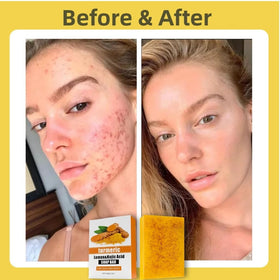 Uselective ingredients label listing kojic acid, turmeric, vitamin C benefits