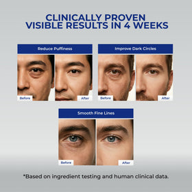 Uttse before and after illustration showing reduced puffiness