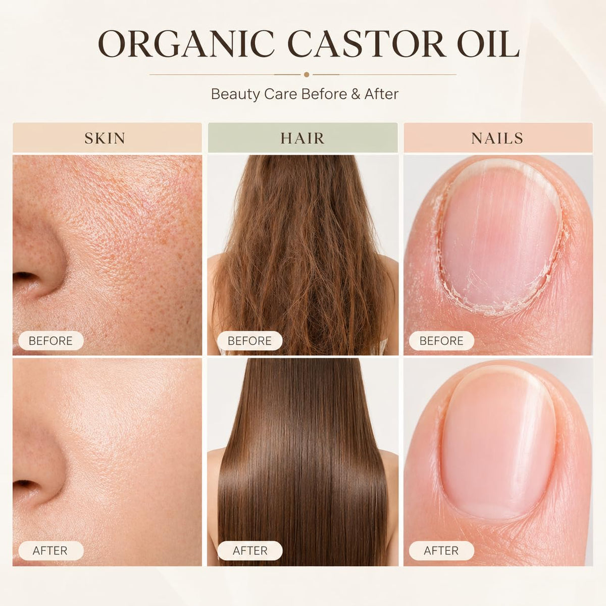 UXZQEN roll-on addressing hairline to moisturize and reduce flakiness