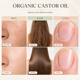 UXZQEN roll-on addressing hairline to moisturize and reduce flakiness