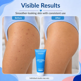 Vanibiss placed in shower routine illustrating easy post-shower use benefit