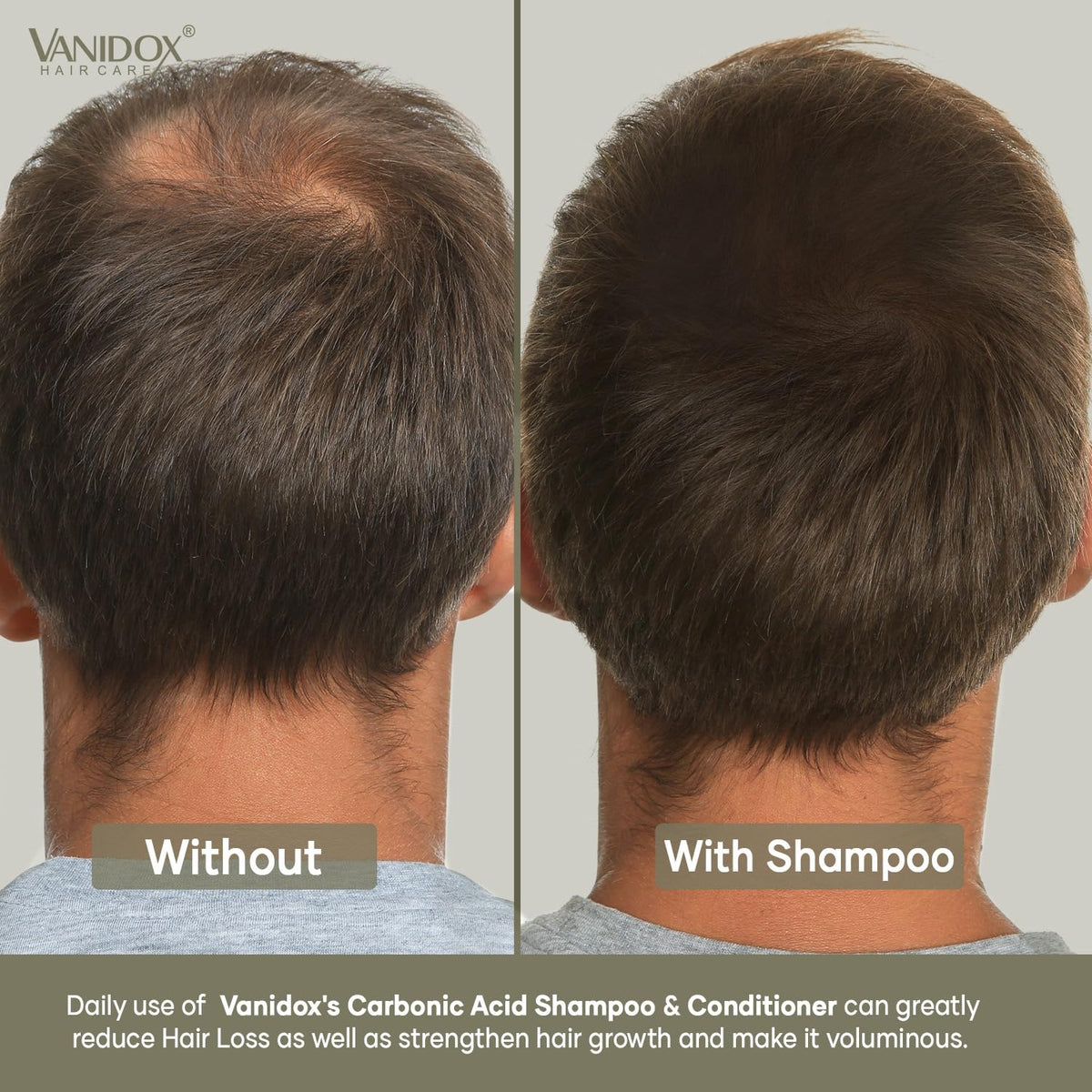 VANIDOX sulfate-free badge emphasizing gentle cleansing benefit