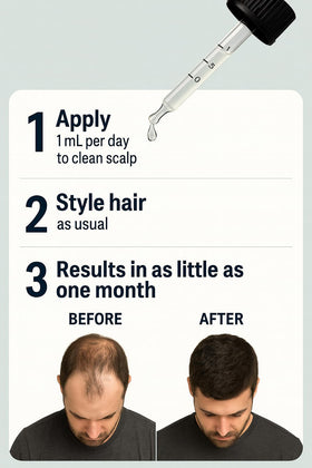 Vantanex dropper applying measured topical dose offering precise scalp application