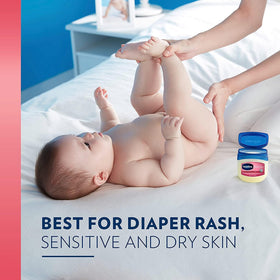 Vaseline applied to diaper area protecting skin from chafing and wetness