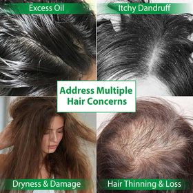 Vawcrn scalp massage application shot, supports healthier scalp circulation and care