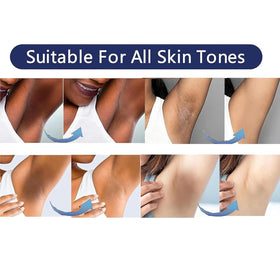 Vcetree applied to inner thigh to show targeted use and even coverage benefit