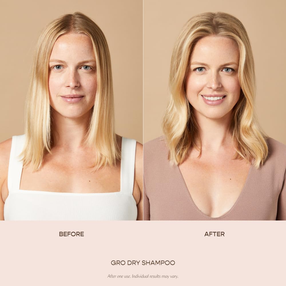 VEGAMOUR before and after showing fuller-looking hair results
