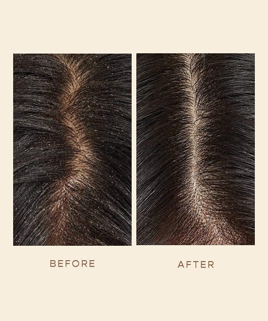 VEGAMOUR serum pictured beside revitalizing shampoo and conditioner for ritual benefit