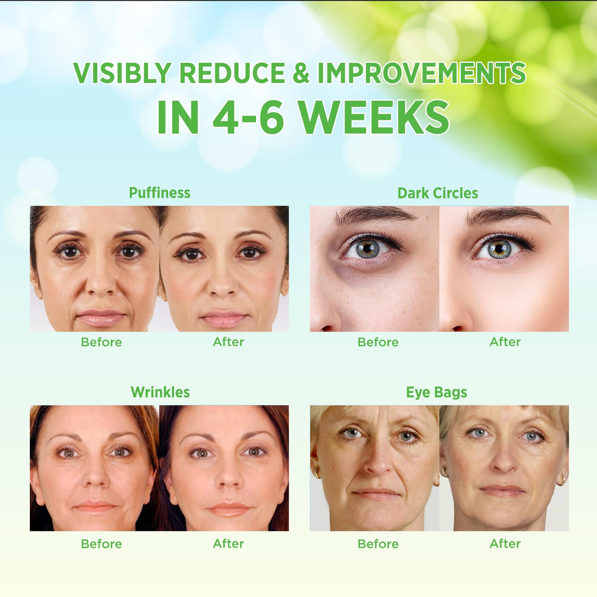 VELAMO ADVANCED under eye patches worn in lifestyle setting for refreshed look