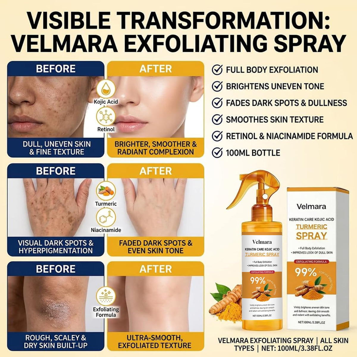 velmara body use on shoulder and knee for all-over gentle resurfacing