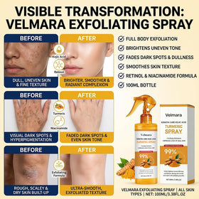 velmara body use on shoulder and knee for all-over gentle resurfacing
