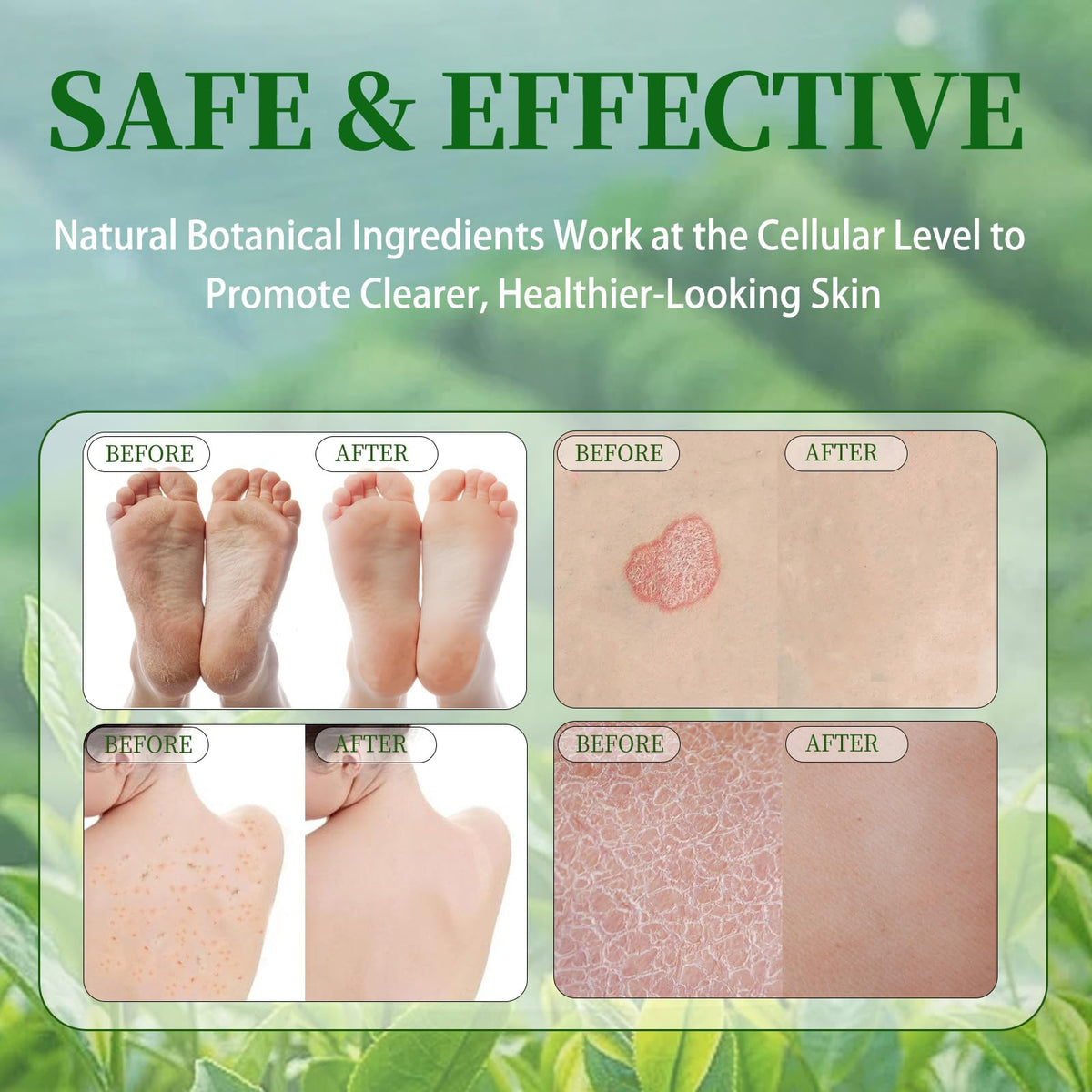 Generic Veloma ingredients flatlay with tea tree and coconut showing natural formula benefit