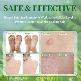 Generic Veloma ingredients flatlay with tea tree and coconut showing natural formula benefit