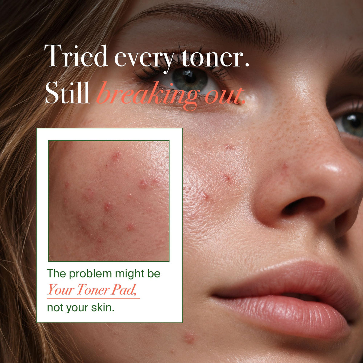 VELVENTE open jar revealing stacked essence-soaked toner pads for easy use