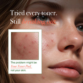 VELVENTE open jar revealing stacked essence-soaked toner pads for easy use