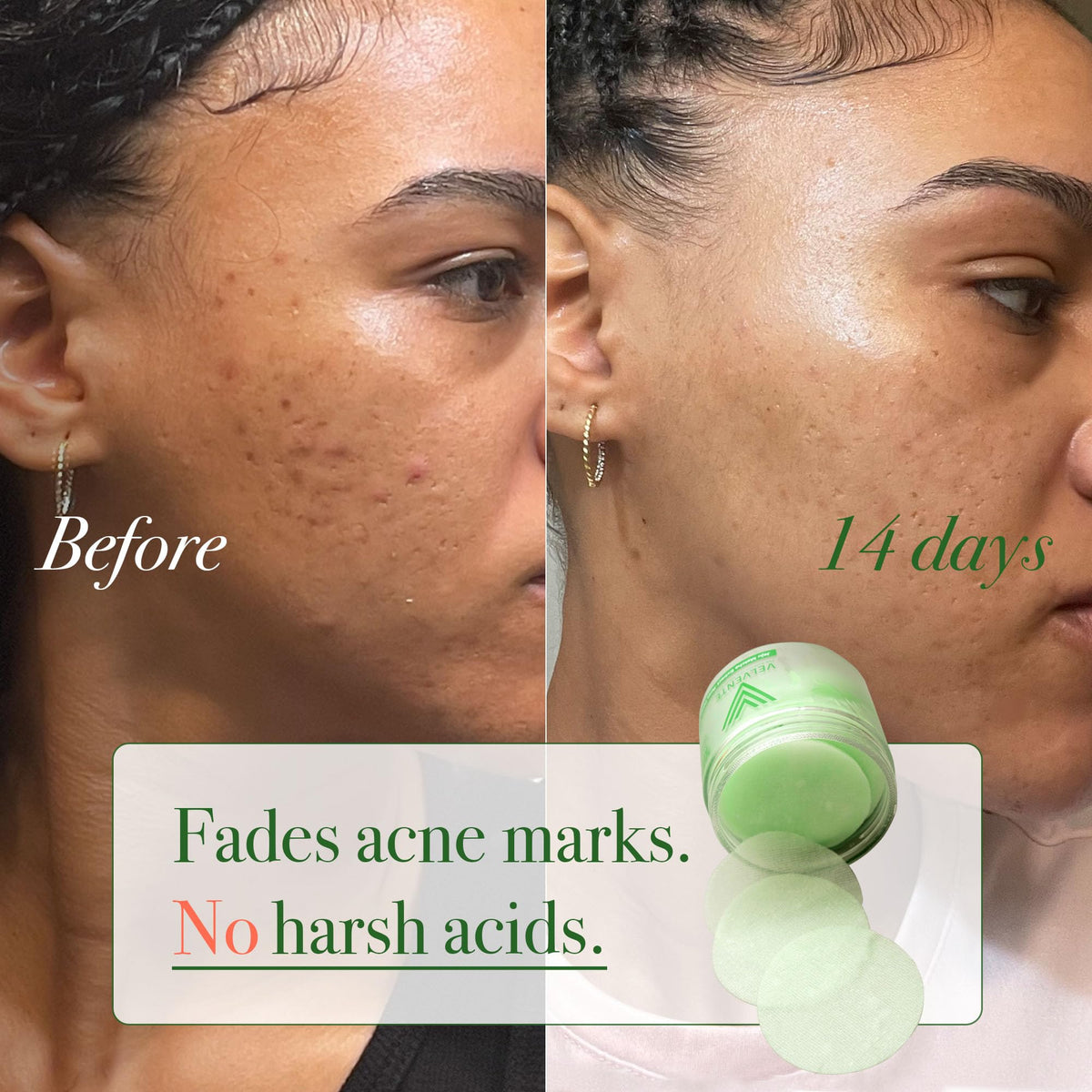 VELVENTE pad being swept on face to calm redness and prep skin