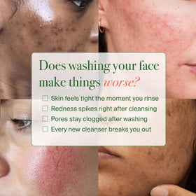 VELVENTE model washing face to show calming, hydrating effect