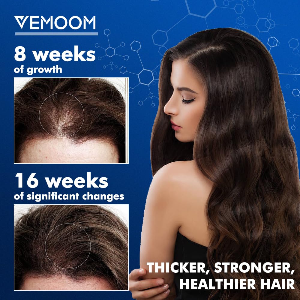 VEMOOM being applied to scalp demonstrating targeted coverage benefit