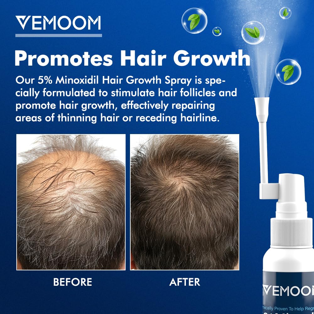 VEMOOM spray nozzle close-up for precise, residue-free application benefit