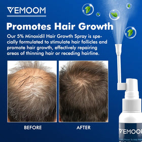 VEMOOM spray nozzle close-up for precise, residue-free application benefit