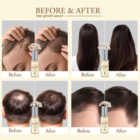 Venanoci dropper dispensing oil, precise application for targeted scalp care