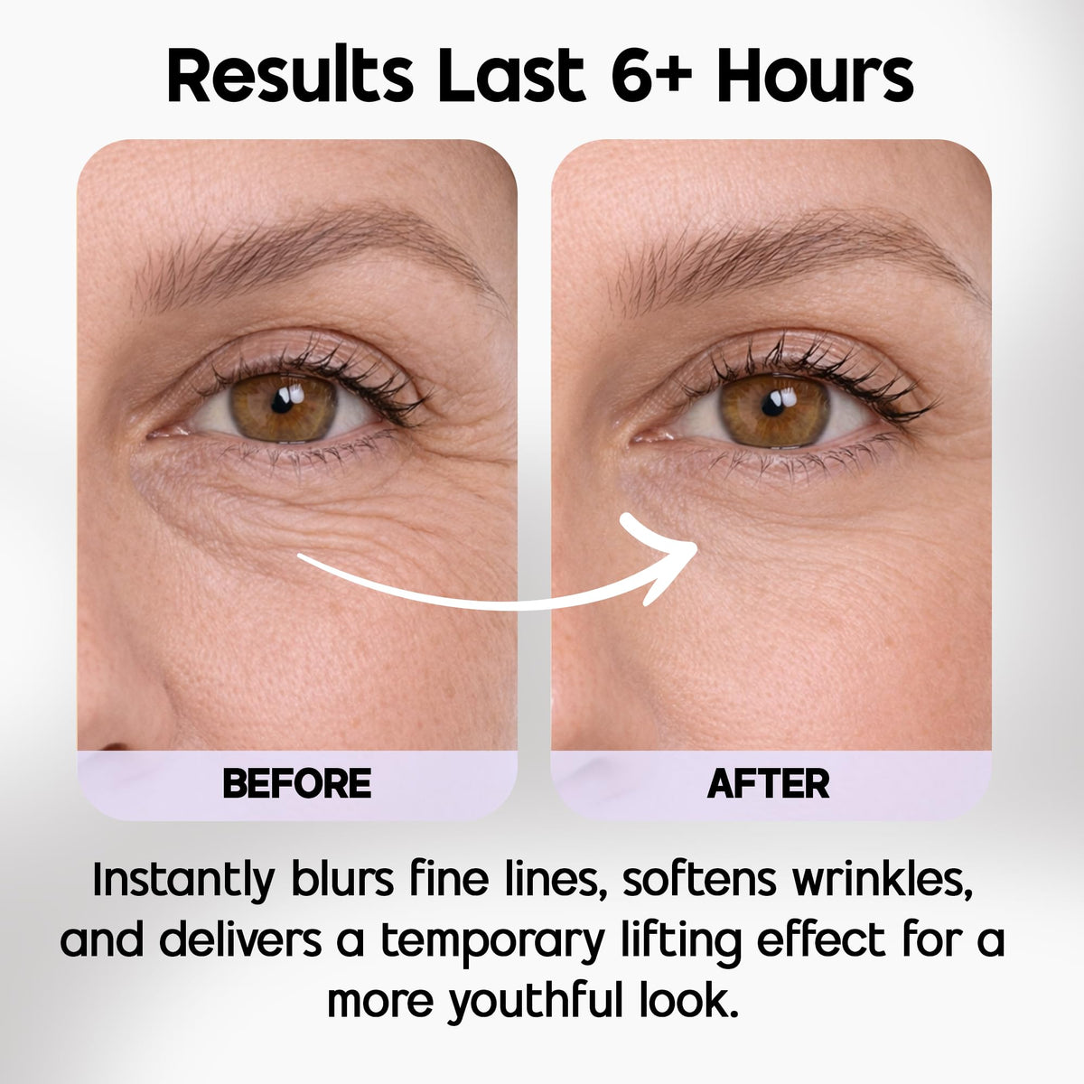 Venofye before and after demo showing reduced appearance of fine lines and lift