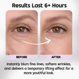 Venofye before and after demo showing reduced appearance of fine lines and lift