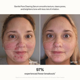 Versed serum on absorbent tissue showing non-greasy finish and quick absorption