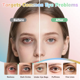 Vetuslumen five-formula display laid out to show variety for targeted under-eye care
