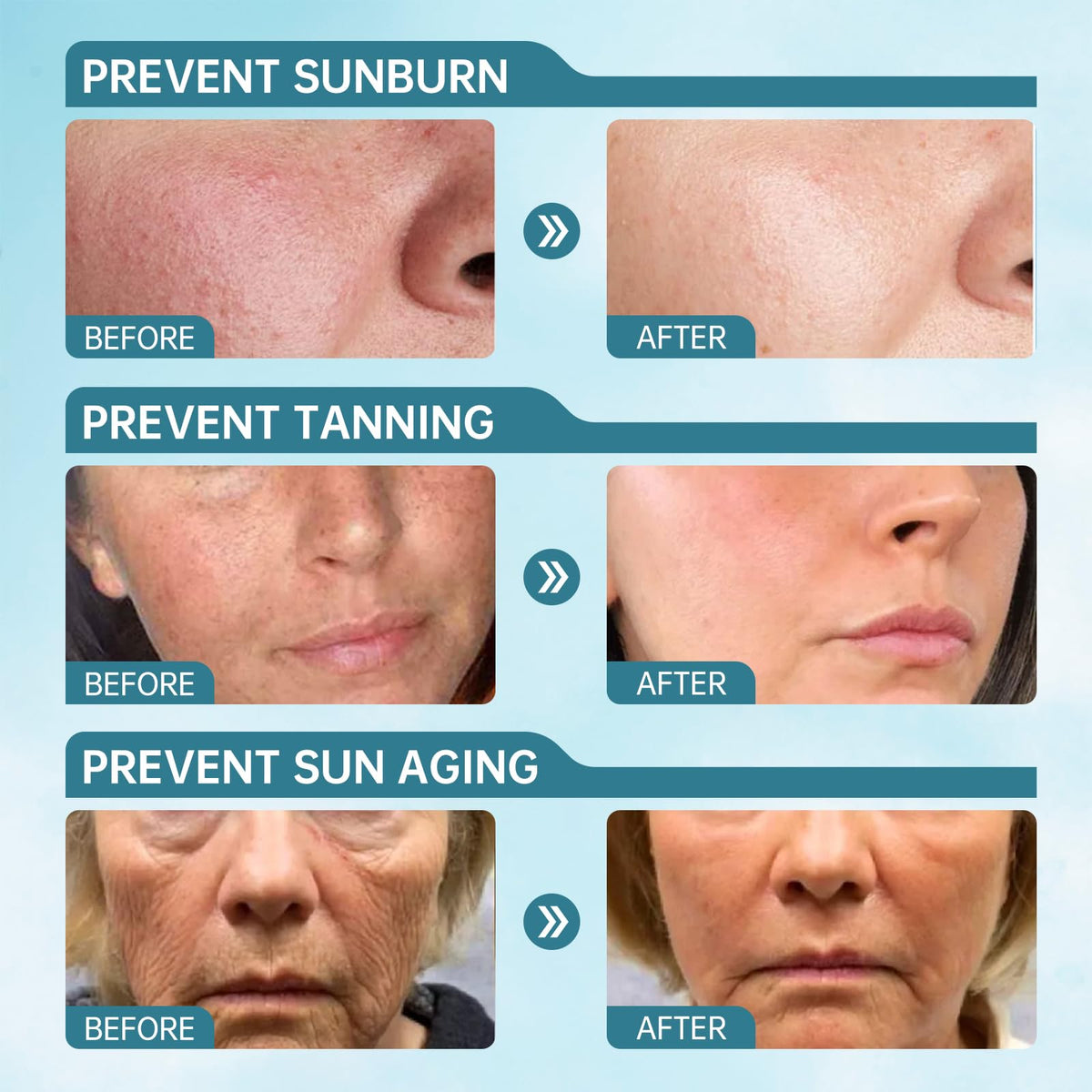 VGO applied on cheek demonstrating smooth, non-greasy sun protection