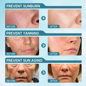 VGO applied on cheek demonstrating smooth, non-greasy sun protection