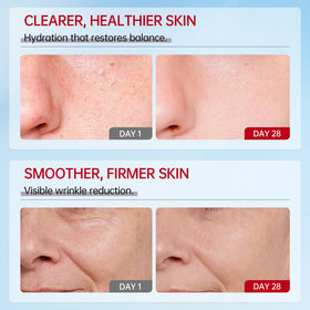 VGO cream on hand showing amount and quick absorption benefit