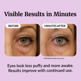Vibriance demonstration applying roll-on under eye for smoothing