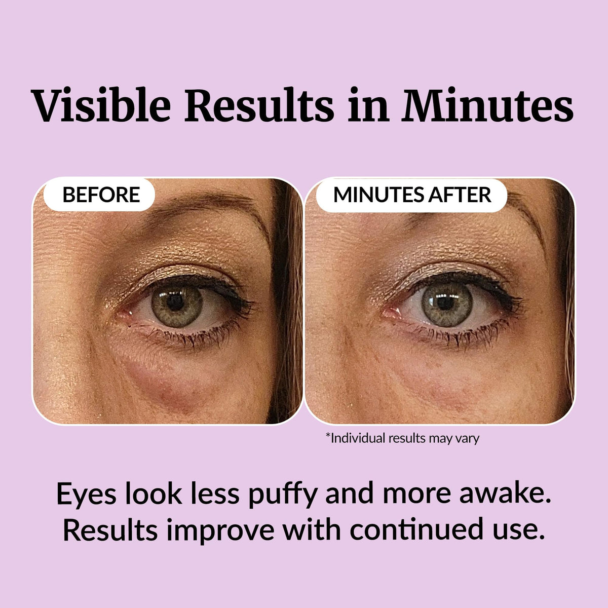 Vibriance applied under eye demonstrating gentle massage and depuffing effect
