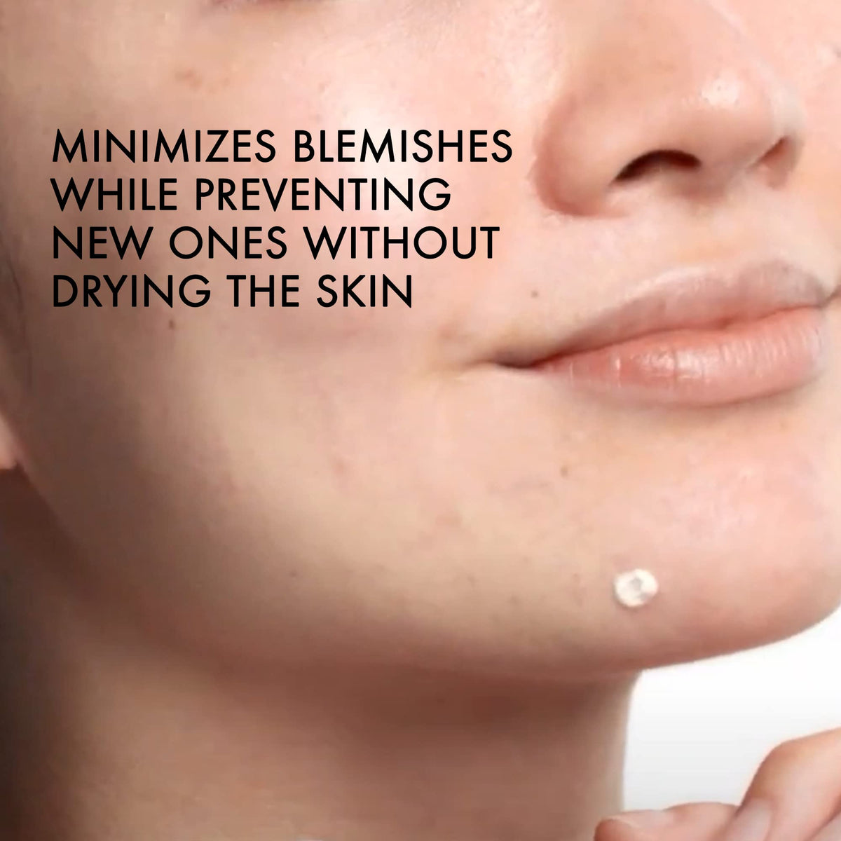 Vichy application image with finger dotting spot to show precise targeted treatment