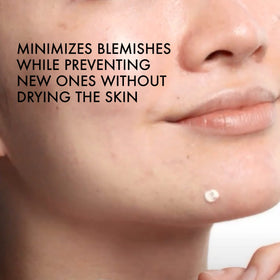 Vichy application image with finger dotting spot to show precise targeted treatment