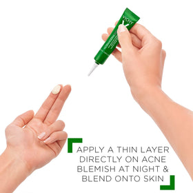 Vichy before and after spot photo emphasizing reduced blemish size and visibility