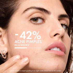 VICHY Normaderm close-up of creamy gel texture that absorbs quickly