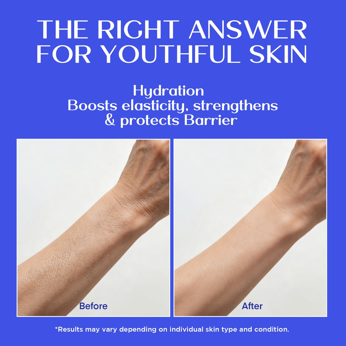 Vigority before after texture comparison visualizing smoother, firmer skin benefit