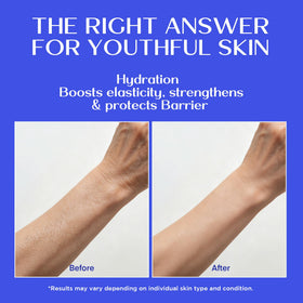 Vigority before after texture comparison visualizing smoother, firmer skin benefit