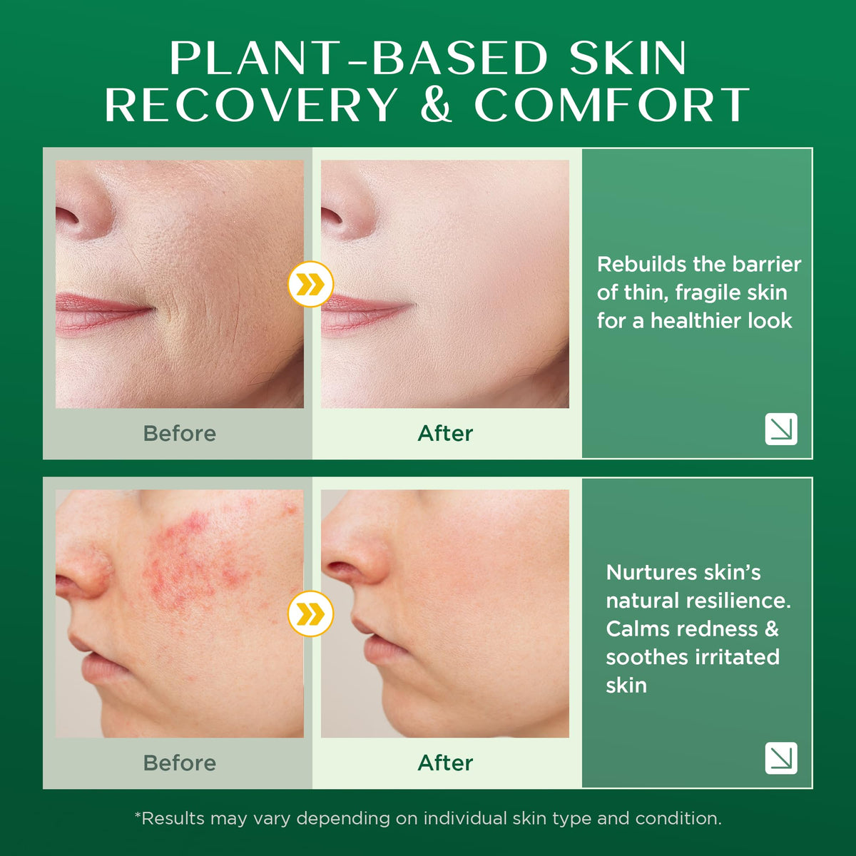 Vigority applied to mature face showing soothing and non-greasy finish