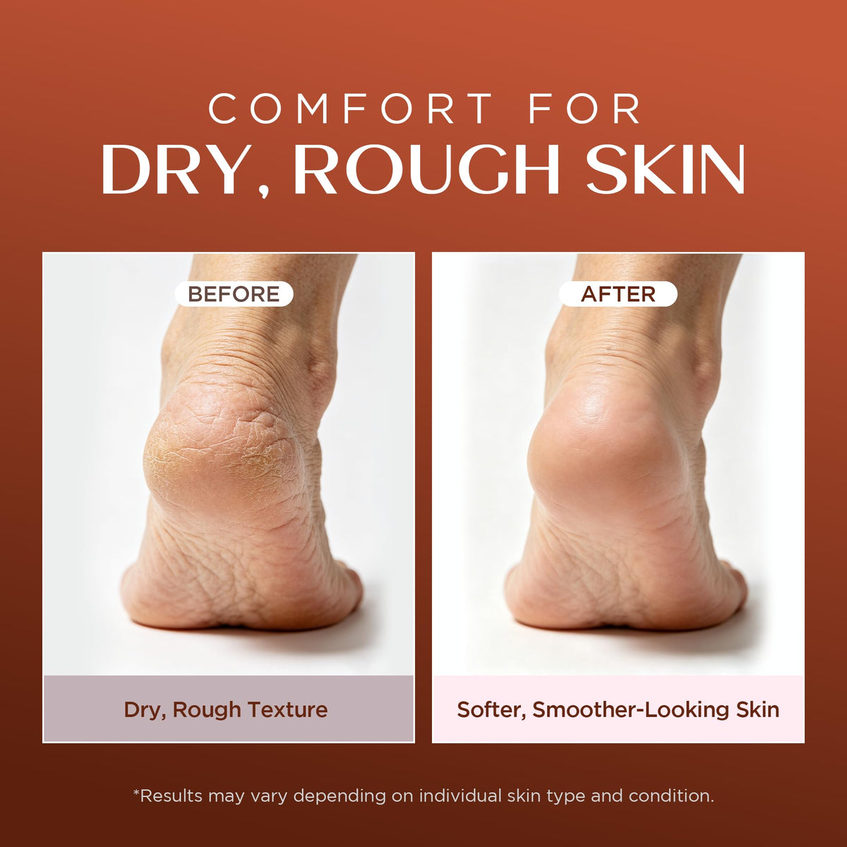 Vigority frankincense balm before and after skin texture comparison showing visible smoothing benefit