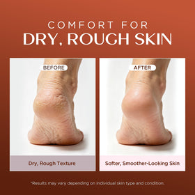 Vigority frankincense balm before and after skin texture comparison showing visible smoothing benefit