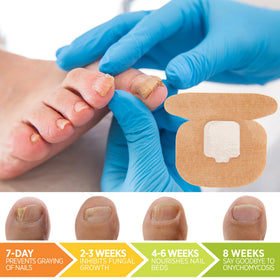 VigorWell before and after nail visual sample showing improved appearance benefit