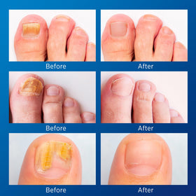 VigorWell sheet of 32 nighttime nail patches demonstrating overnight protection