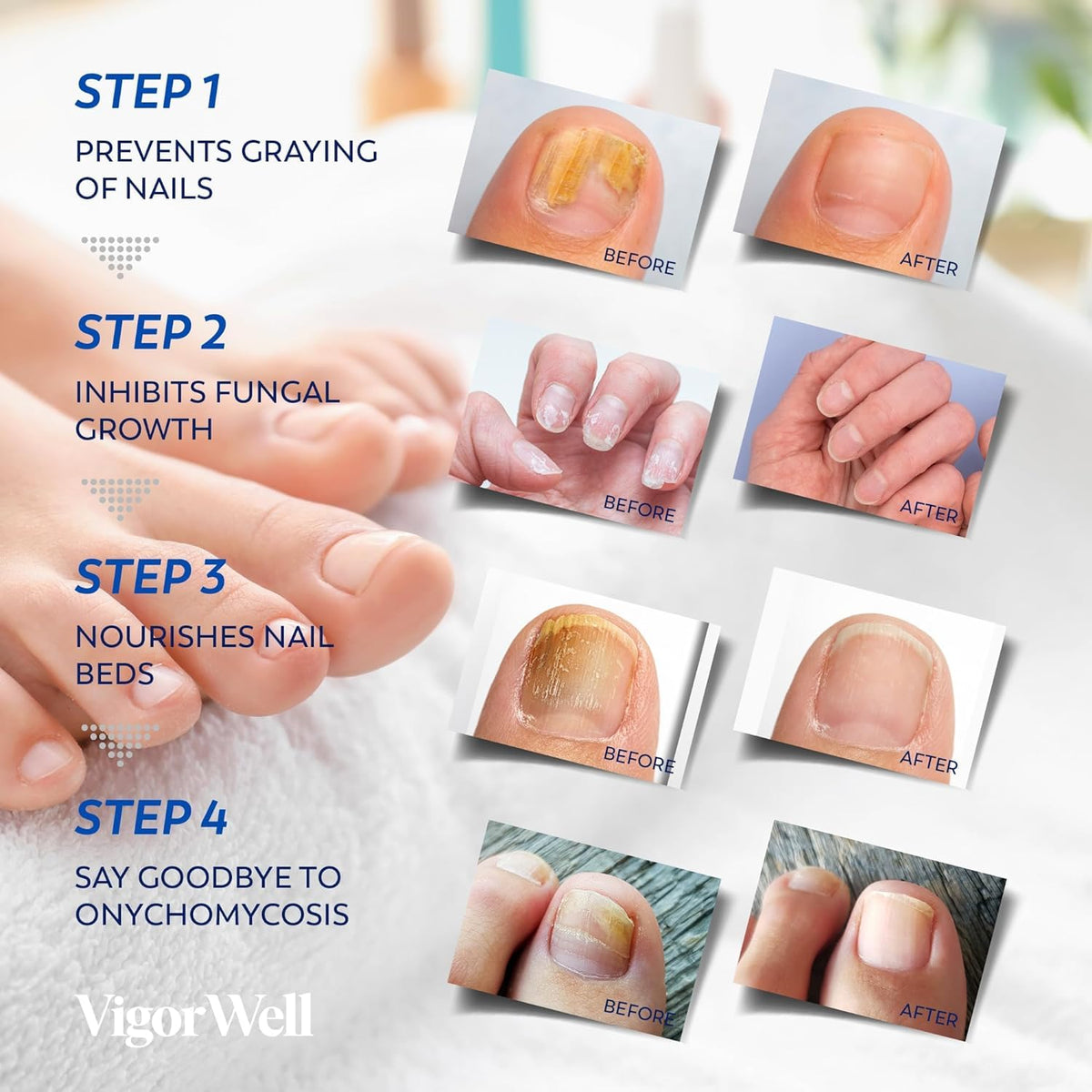 VigorWell Nail Renewal Liquid bottle label visible for clear product identification