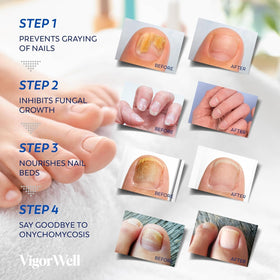 VigorWell Nail Renewal Liquid bottle label visible for clear product identification