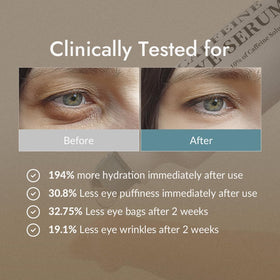 VILLAGE11FACTORY before and after depiction showing reduced puffiness benefit