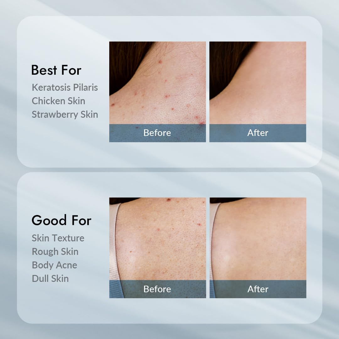 VILLAGE11FACTORY illustrative before and after result concept for smoother skin